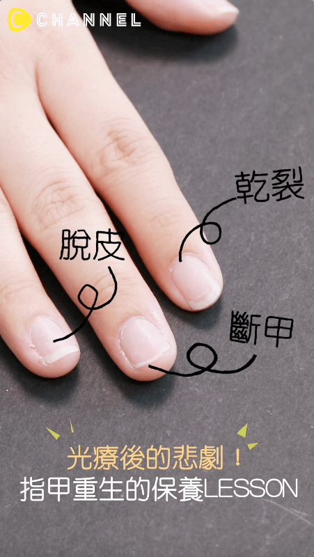光療後的悲劇！指甲重生的保養HOW TO DO