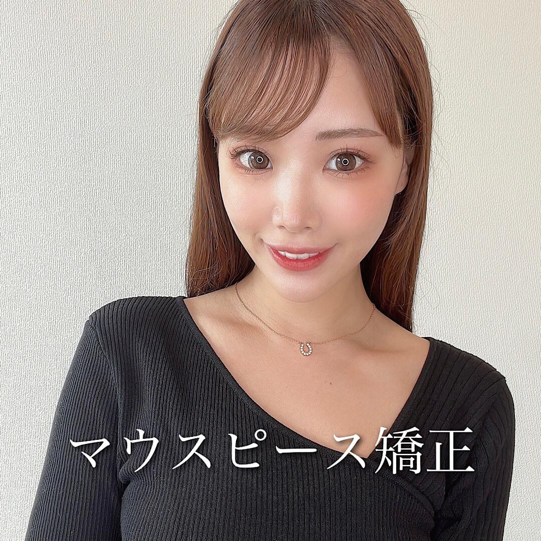 マウスピース矯正開始！