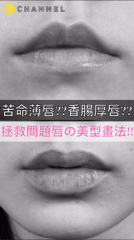成為理想中的韓妞嘟嘟唇！問題唇的微整形美唇技巧