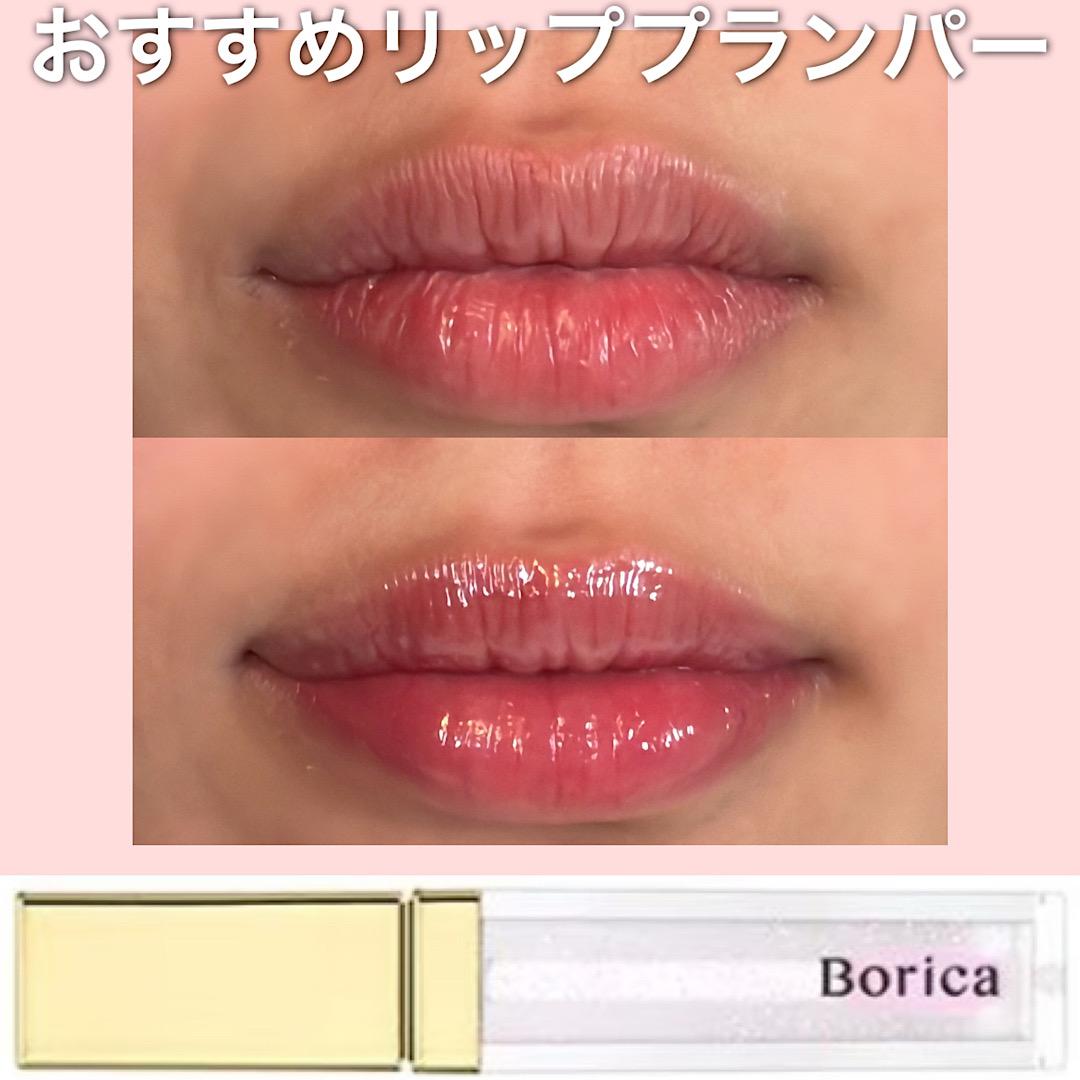 おすすめリッププランパー