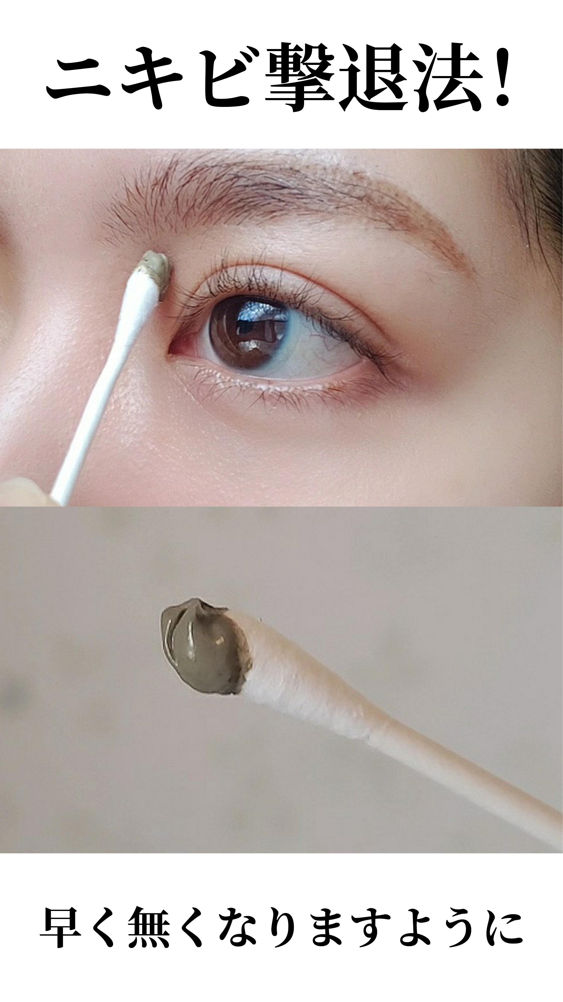 【私のニキビ撃退法！】オーガニックアイテムでニキビ撃退！