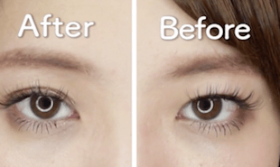 おすすめのアイプチをご紹介 ぱっちり二重になれる